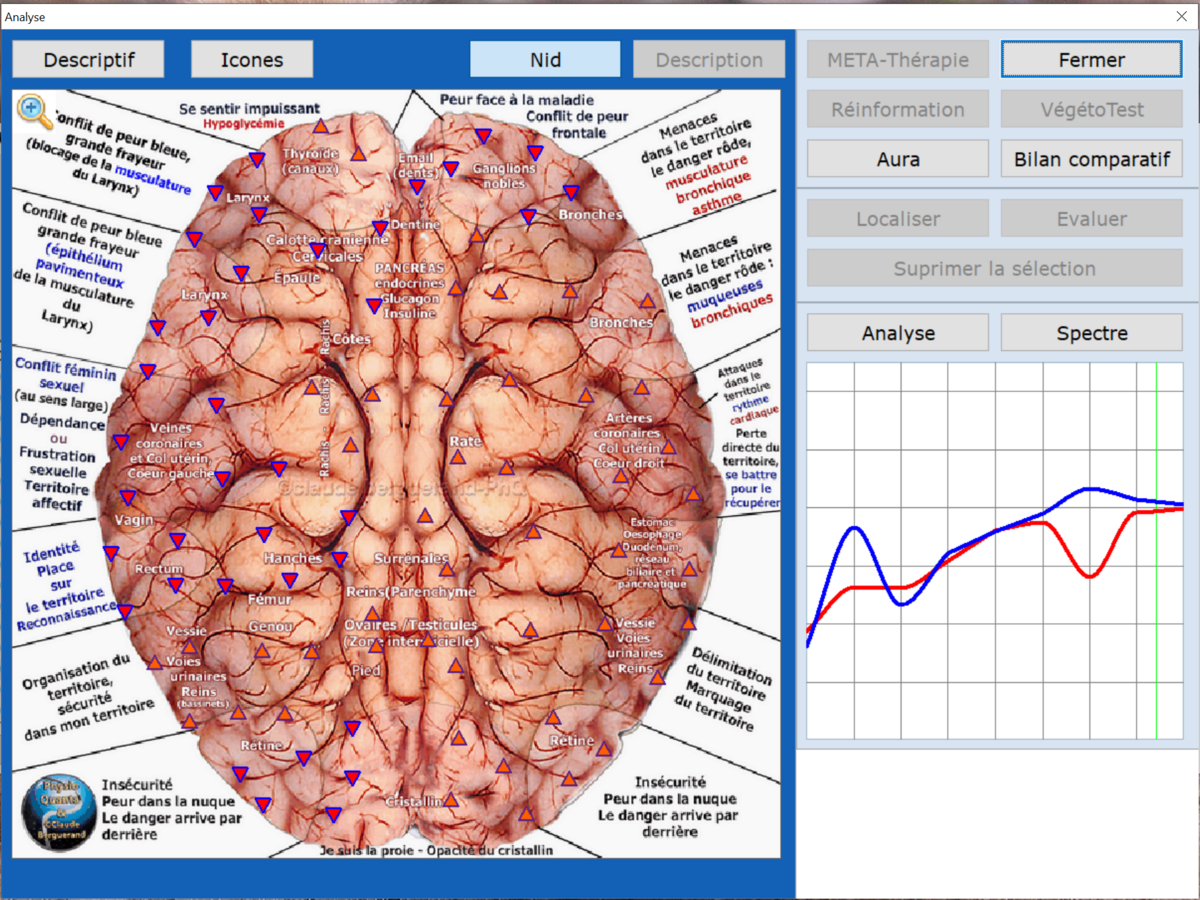 Planche du Physioscan : coupe du cortex cérébral, avec les courbes d'analyse